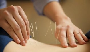 acupuncture for prostatitis