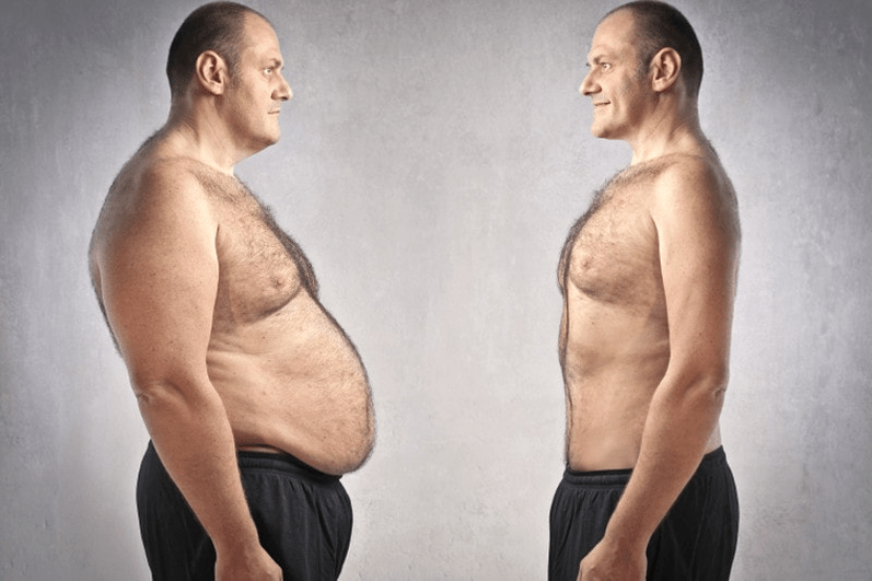 overweight with prostatitis