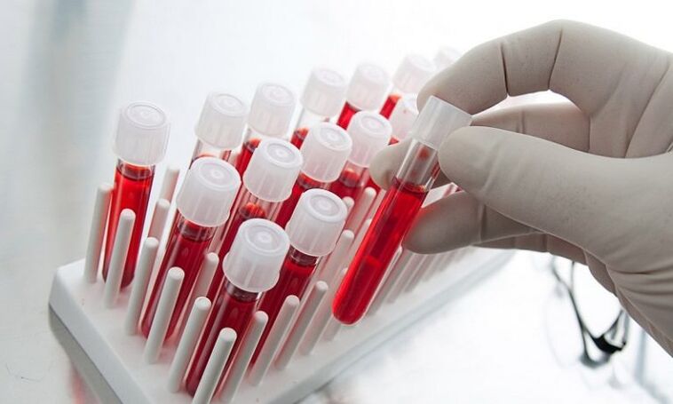 blood in test tubes for a dog with prostatitis