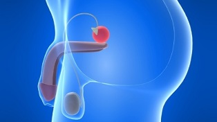 prostate massage for the prevention of prostatitis