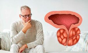 A man has chronic prostatitis